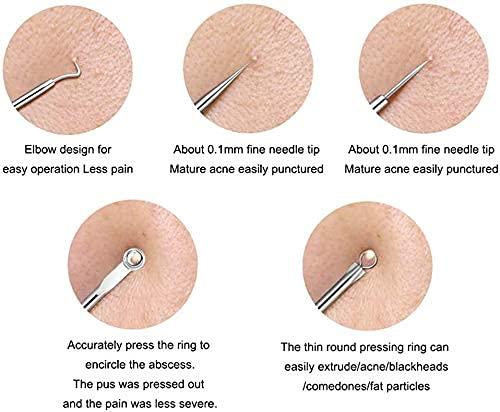 Stainless Steel Blackhead Remover Tool Set of 4 & Ear Pick Earwax Removal Kit of 6