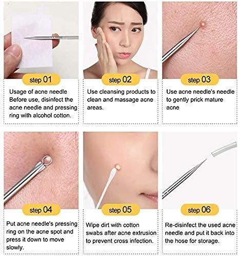 Stainless Steel Blackhead Remover Tool Set of 4 & Ear Pick Earwax Removal Kit of 6
